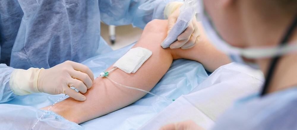 How to cure varicose veins