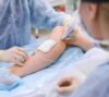 How to cure varicose veins