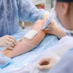 How to cure varicose veins