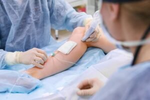 How to cure varicose veins